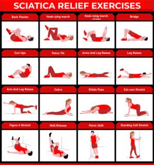 XYR7CCB6 Sciatica Relief Exercises
